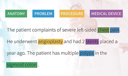 Text Classification